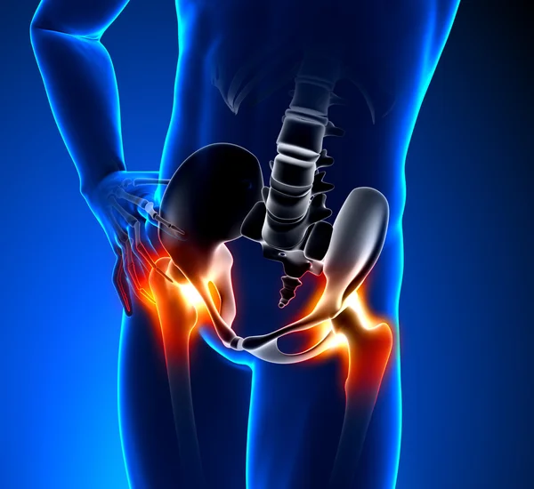 Can Low Back Pain Lead to Hip Problems?