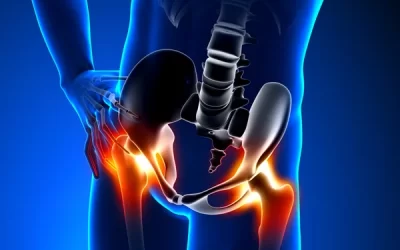 Can Low Back Pain Lead to Hip Problems?